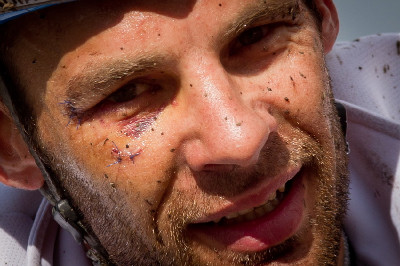 sešitý silničář Jean Christiphe Peraud