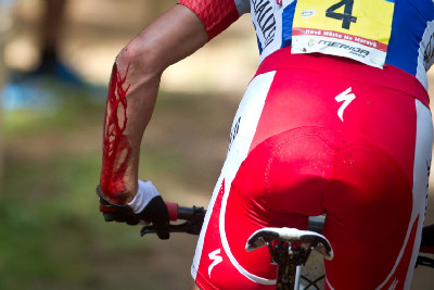 Loket Burry Standera