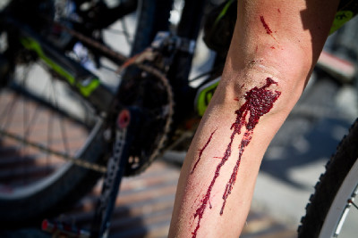 kyperský lišej Ondřeje Cinka