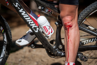 JK po střetu s jinou závodnicí