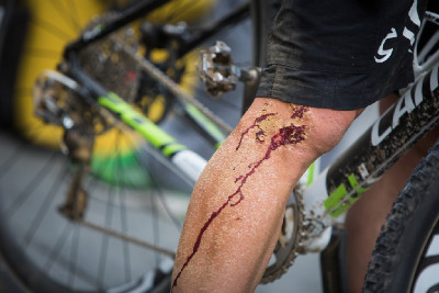 Ani Fontana se nevyhnul pádu