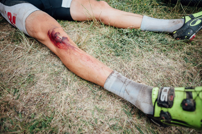 Český pohár XCO 2016 - Brno