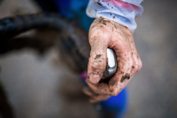 Tereza Vaníčková a její ruce po šichtě