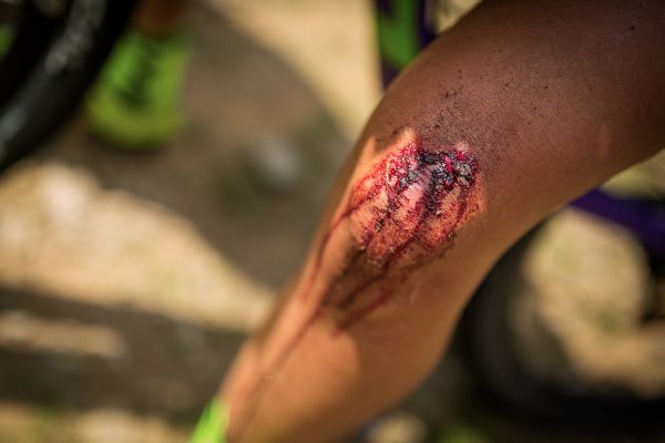 Český pohár XCO #4 - Zadov 2018