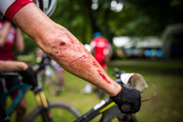 Kupkolo MTB Trilogy 2020