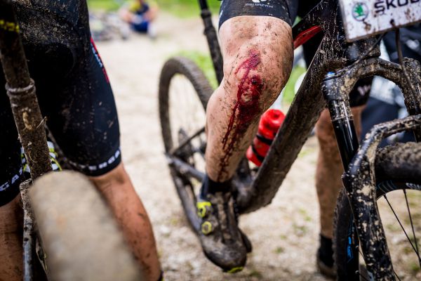 Český pohár XCO 2021 - #3 Bedřichov