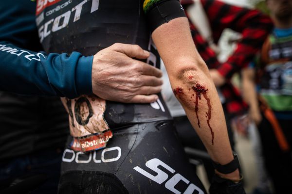 Světový pohár XCO #2 - Albstadt