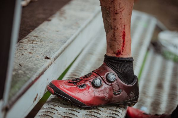 Kupkolo MTB Trilogy 2022